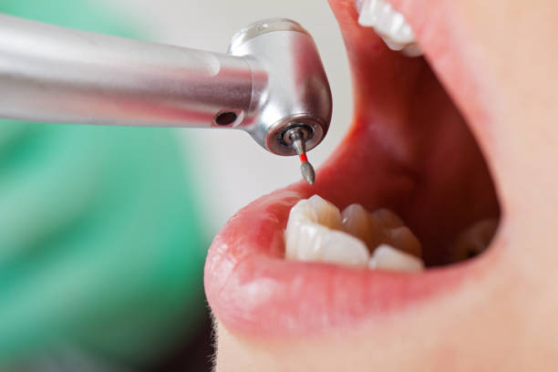 Best Pediatric Emergency Dentist in Livingston, CA